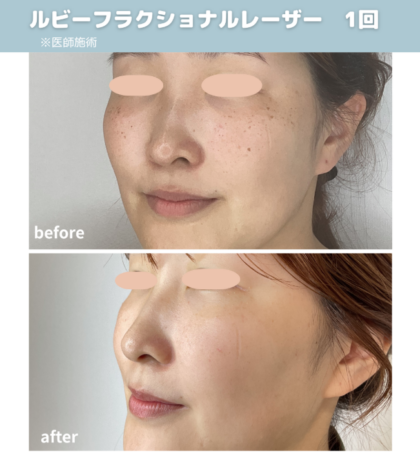 症例紹介（Before / After）
