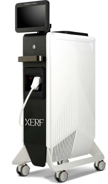 他のRF製品との違い・XERFだけの優位性